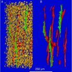 1462381431bone-microcracks_large