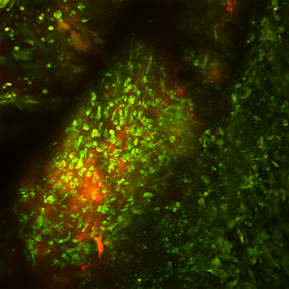 Confocal2 Confocal2